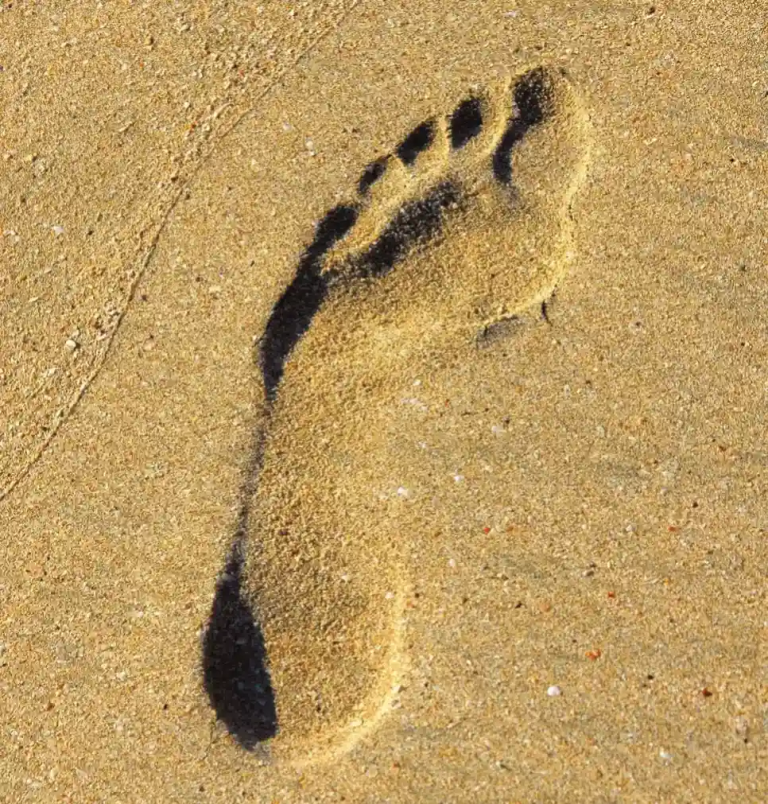 footprint in the sand, plantar fasciitis treatment at home